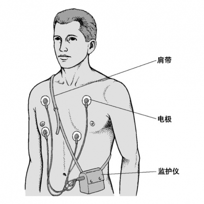 google-wearable-ecg-patent-2.jpg